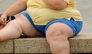 woman with Obesity