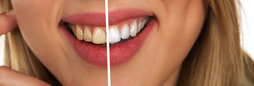 browns vs white human teeth