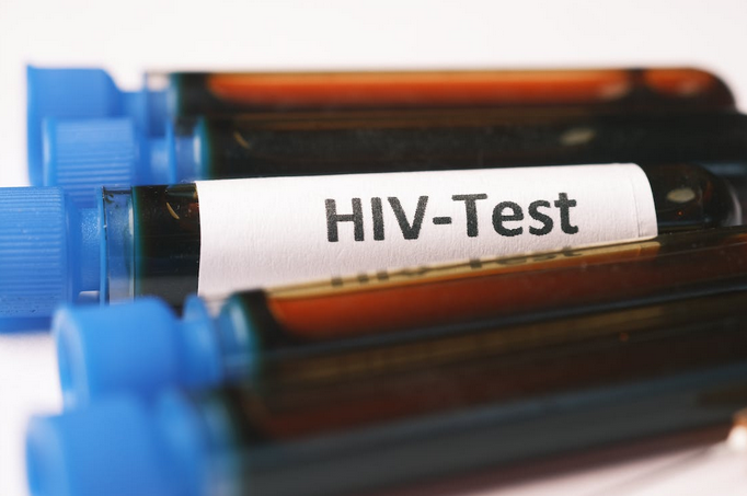 HIV